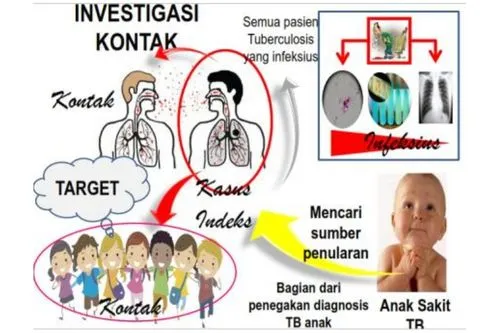 investigasi kontak TB laten