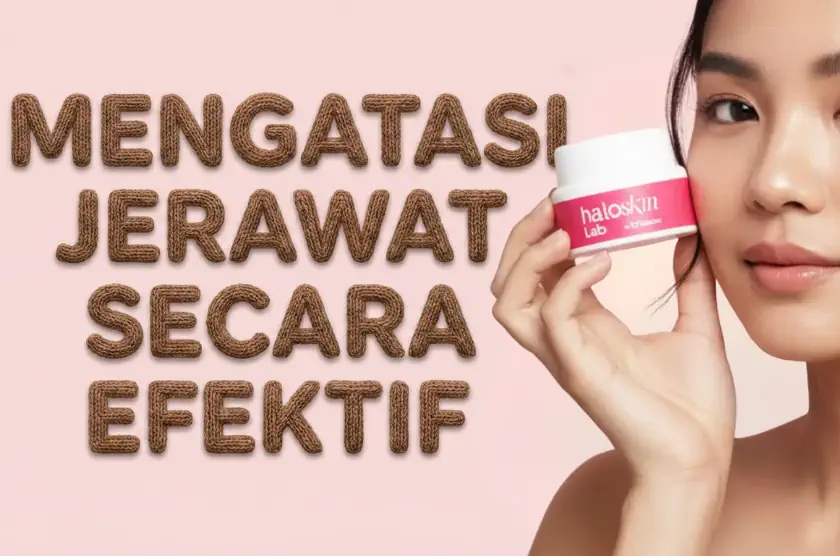 Mengatasi Jerawat Secara Efektif